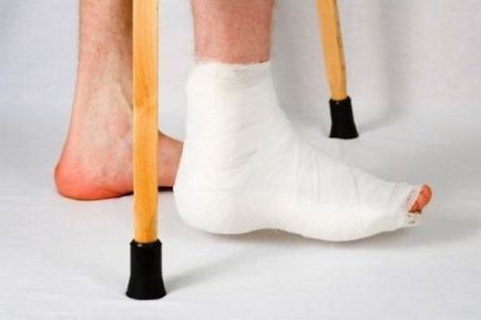 Fractura piciorului, simptomele osoase navicular și tratament, ce să facă, perioada de recuperare