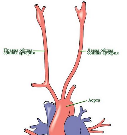 Sleepy човешки артерия, горните и долните каротидни артерии