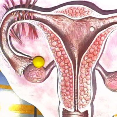 simptome de ovar chistadenomul, cauze si tratament