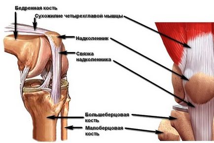 Счупване на коляното (патела), симптоми, лечение, последствията