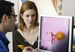 Polichistic ovarian - tratament, simptomele, cauzele