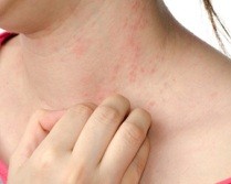 pete roșii pe piele alergii cauze si tratament