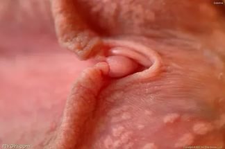 Papilom vaginal - Papilom vagin