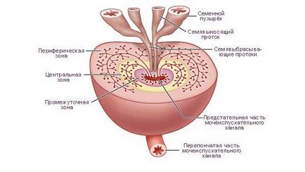 fibroza prostatitei