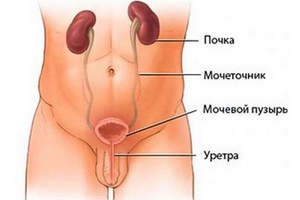 eliminare calcificari prostata)