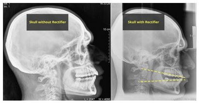 Comment développer, élargir et rendre votre visage plus symétrique (votre) Comment développer, élargir et rendre votre visage plus symétrique