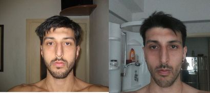 Comment développer, élargir et rendre votre visage plus symétrique (comment faire un visage de la pensée) Comment développer, élargir et rendre votre visage plus symétrique