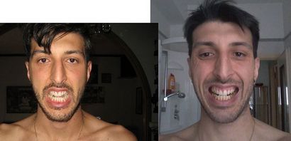 Comment développer, élargir et rendre votre visage plus symétrique (faire) Comment développer, élargir et rendre votre visage plus symétrique