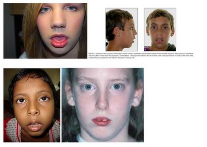 Comment développer, élargir et rendre votre visage plus symétrique (développer) Comment développer, élargir et rendre votre visage plus symétrique