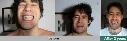 Comment développer, élargir et rendre votre visage plus symétrique (développer) Comment développer, élargir et rendre votre visage plus symétrique