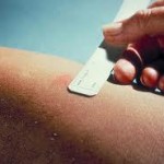 Test cutané à la tuberculine Résultats positifs et négatifs du test cutané à la tuberculine (comment faire négatif test de Mantoux) Test cutané à la tuberculine Résultats positifs et négatifs du test cutané à la tuberculine
