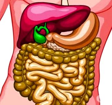 colecistectomie