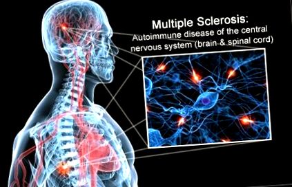 sclerozei