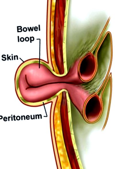 tratamentul