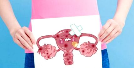uterine disfuncționale