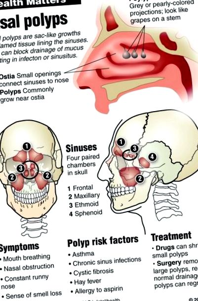 polipilor