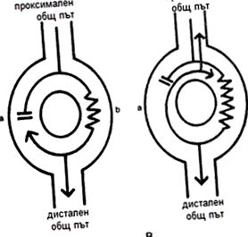 complex ventricular