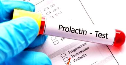 prolactină