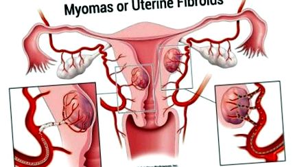 uterine