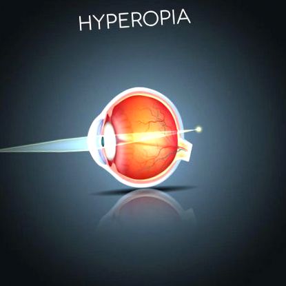 hipermetropia