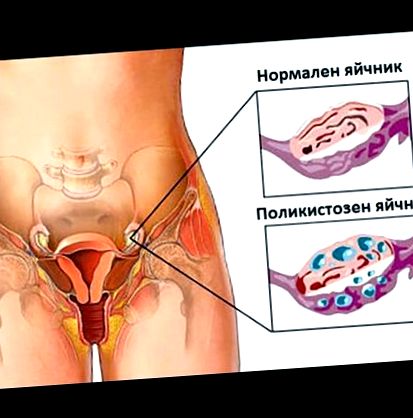 ginecologii