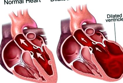 boli inimă