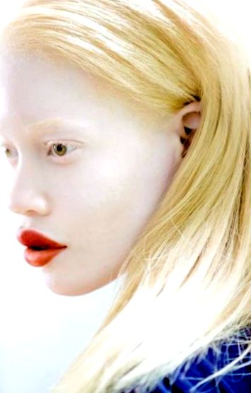 albínó