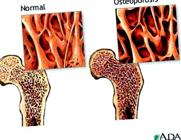 diagnostic tratament