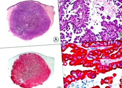 progenitoare endoteliale