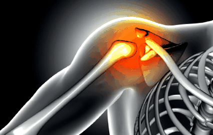 a vállízületek konzervatív kezelésének osteoarthritisje jobb csukló artrózis kezelése
