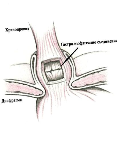 articulația gastroesofagiană