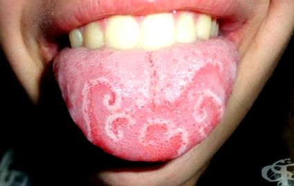 suprafața limbii
