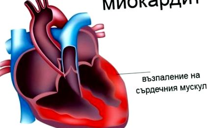 miocarditei infecțioase