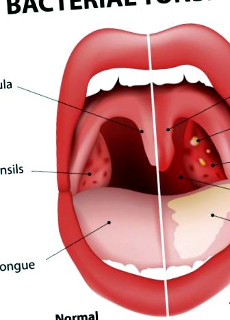 diagnostic