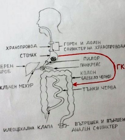 sindromul