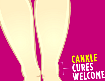 cankles