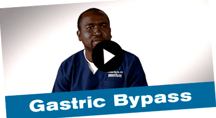 Bypass gastric