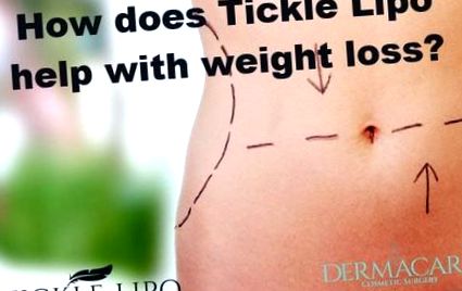 tickle