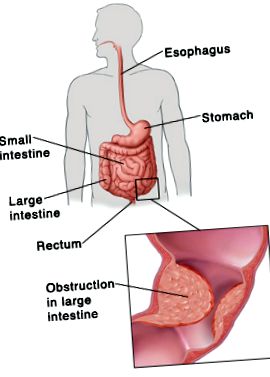 intestinului