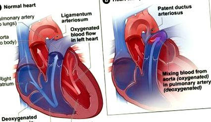 cardiotoracică