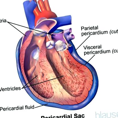 pericardită