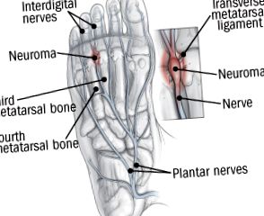 neurom