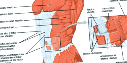 diastasis