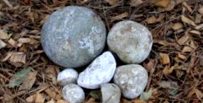 кишкові камені