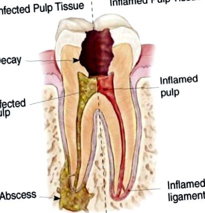 pulpitei