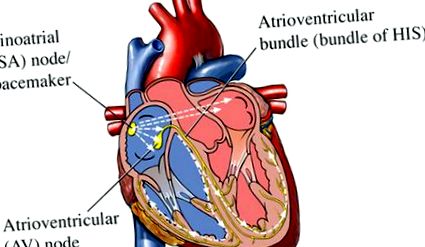 сърдечни аритмии