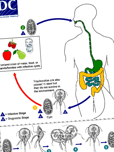 giardia