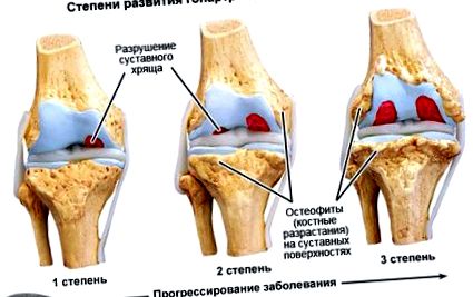 причини