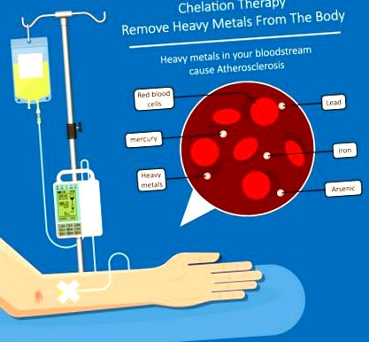 chelation