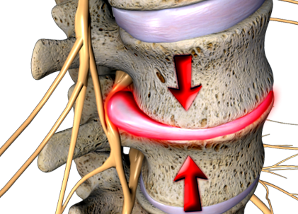 vertebrale